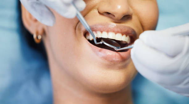 Best Knocked-Out Tooth (Avulsed Tooth) Treatment in Windom, MN